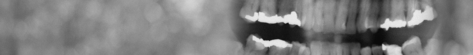 Pantomogram (RTG zęba)